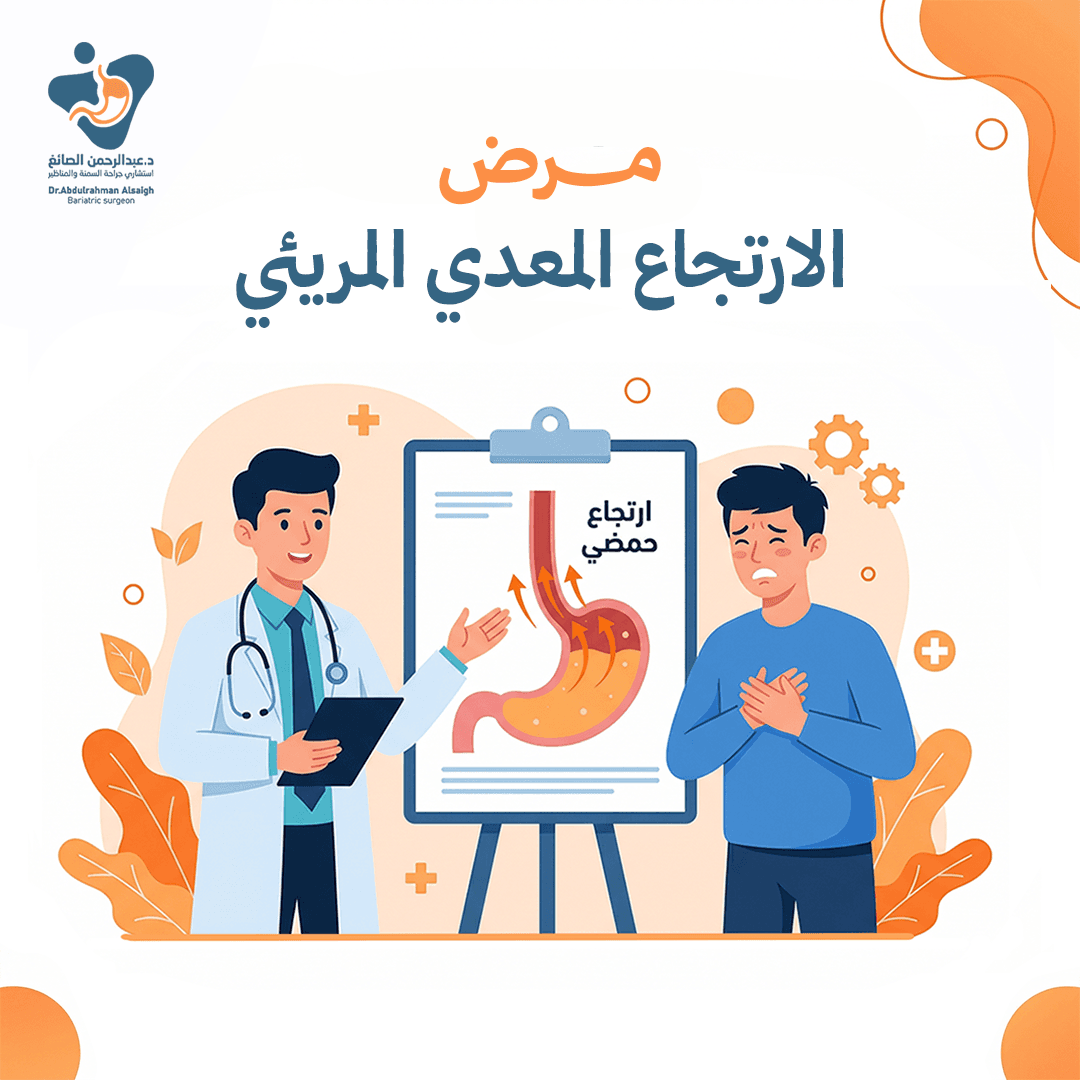 مرض-الارتجاع-المريئي