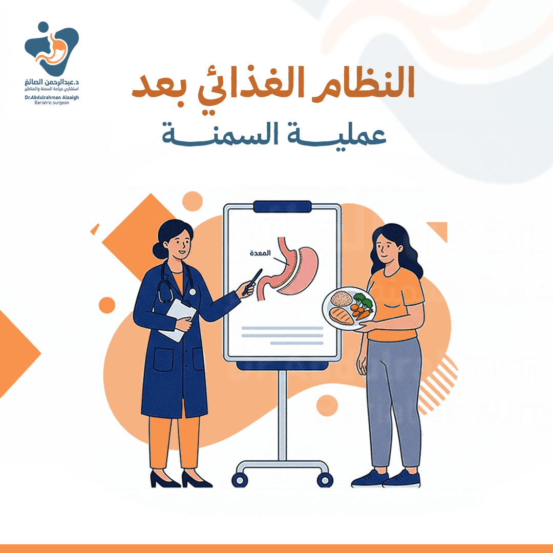النظام الغذائي بعد عملية السمنة