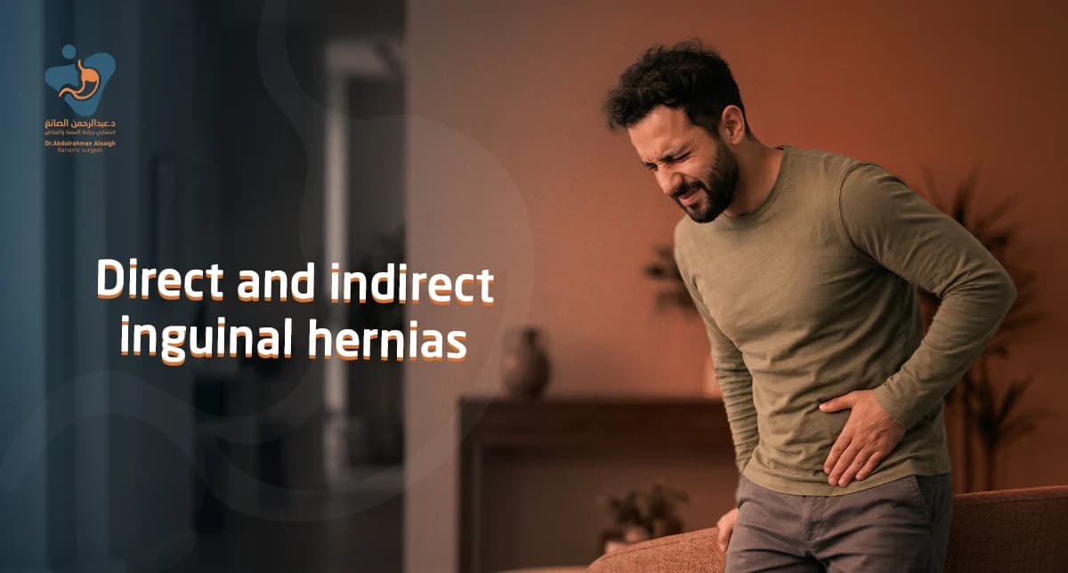 Direct and Indirect Inguinal Hernia